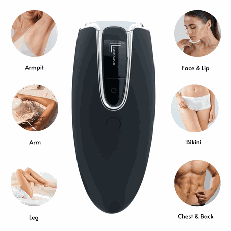 Lumilia hair removal device